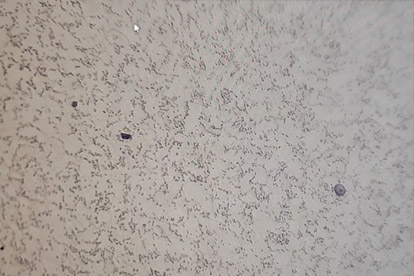 Altın Faz Tespiti-500 Kez Altın Faz